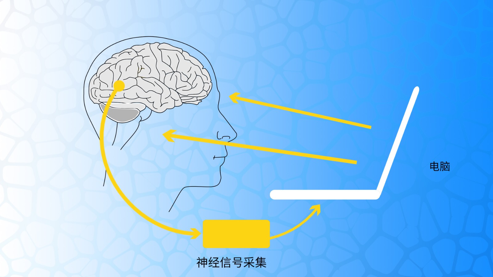 腦電在神經生物反饋中的應用